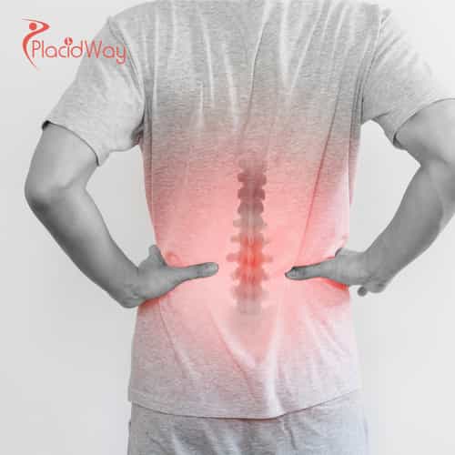 Advanced Stem Cell Therapy for Failed Back Surgery Syndrome (FBSS) in India
